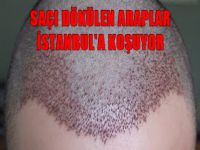 Saçı dökülen Araplar İstanbul'a koşuyor