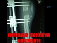 Kopan bacak hem dikiliyor hem uzatılıyor