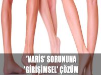 'Varis' sorununa 'Girişimsel' çözüm