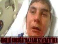 Engelli çocuğu yakarak eziyet ettiler