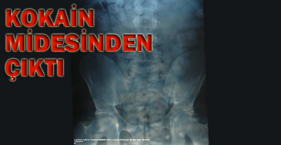 Kokain midesinden çıktı