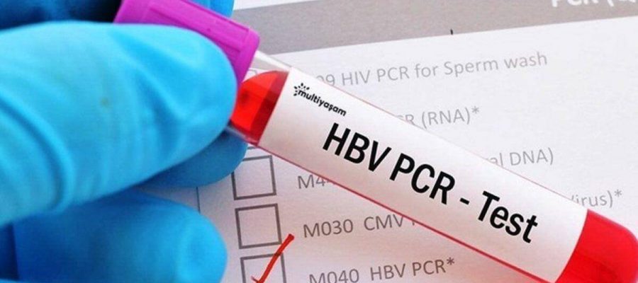 PCR testi pozitif çıkarsa kaç gün karantina?