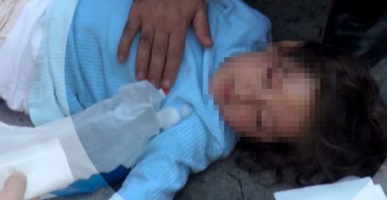Kaza mağduru minik Ebru görmeye başladı