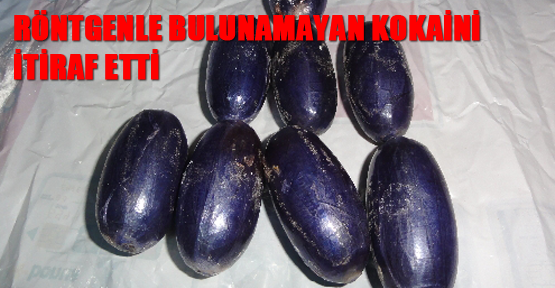 Röntgenle bulunamayan kokaini itiraf etti