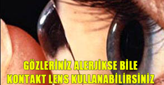 Gözleriniz alerjikse bile kontakt lens kullanabilirsiniz