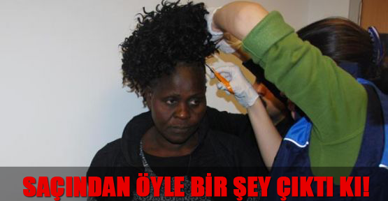 Saçından öyle bir şey çıktı ki!