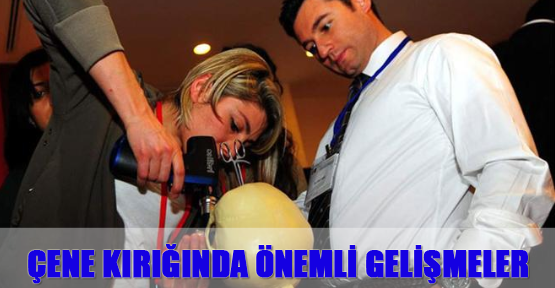 Çene kırığında önemli gelişmeler